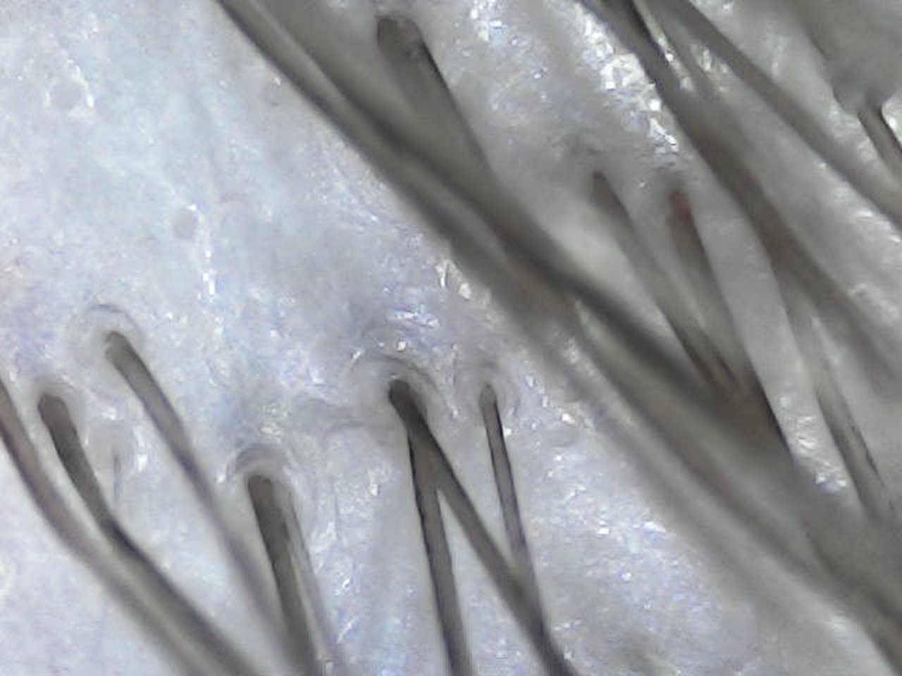 Scalp seen through the NioScope after a scalp care appointment at ELM, Wrexham
