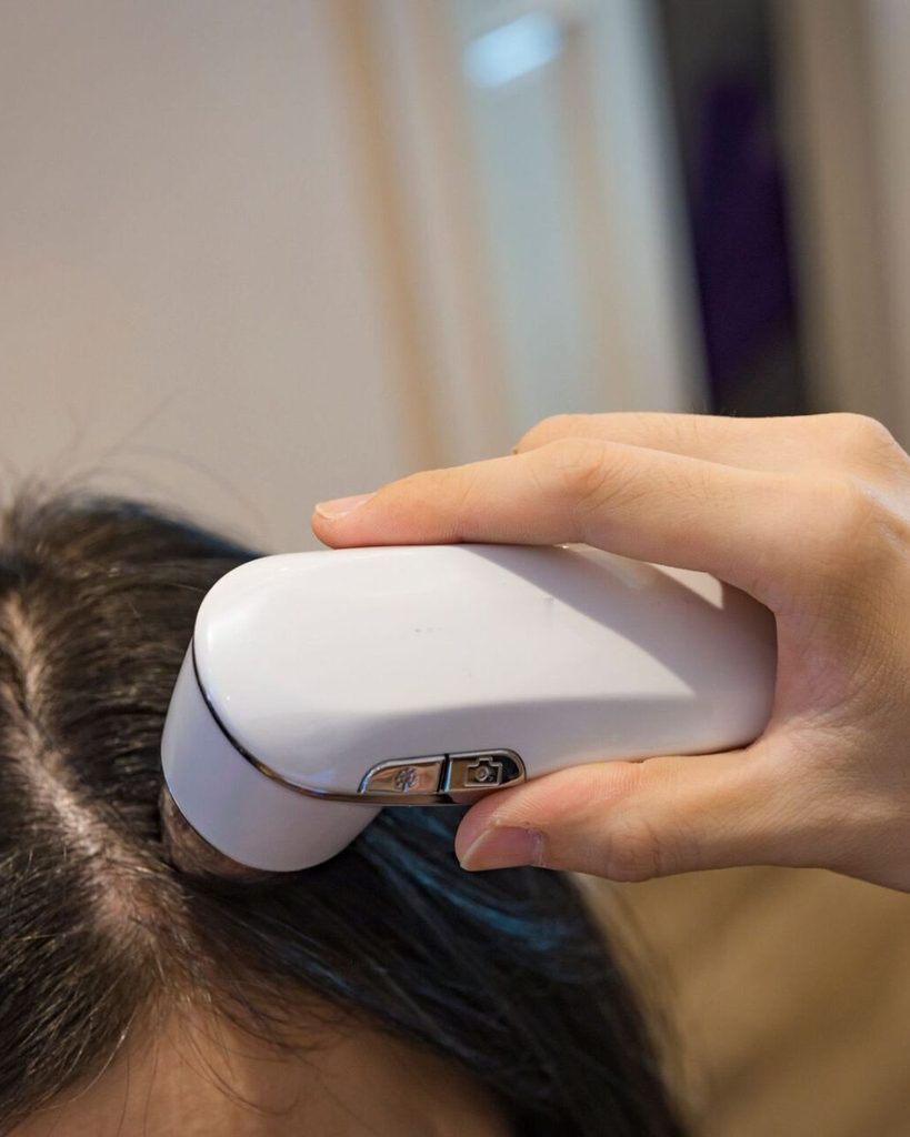 Scalp consultation with a magnifying scope